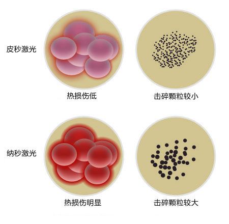 140455502.jpg 5-1.jpg