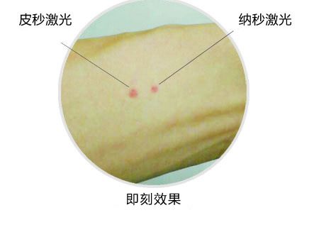 140500351.jpg 5-2.jpg