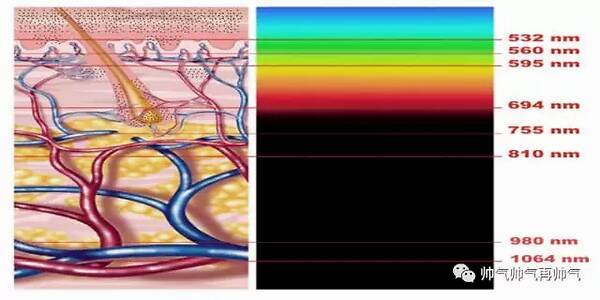 各个波长的激光在美容领域的应用